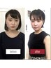 【たるみ改善×顔のゆがみ】人気No.1小顔矯正60分￥14,980