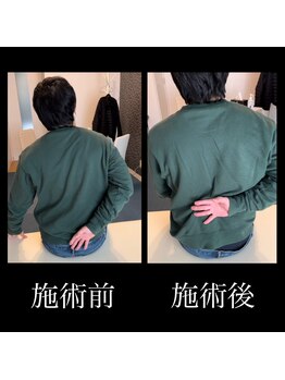 カラダラボ(Karada LAB)/Before After