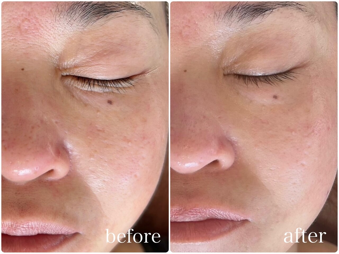 ベル(Belle)｜ホットペッパービューティー