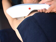 ノーブル(NOBLE)/全身脱毛（ワキ）　施術（１）