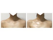 エフハリスト 表参道 外苑前(Efcharisto`)/before after90分