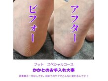 マユネイル(mayunail)の雰囲気（サンダル履くならまずは足裏から綺麗に♪角質除去も人気のサロン）