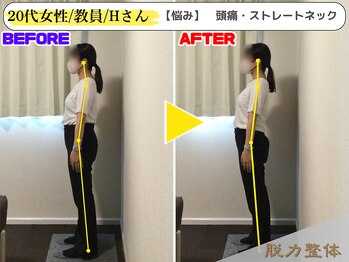 幸せのもり整体院/20代女性/教員/Hさん