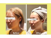 アン 銀座(ann)/別人級