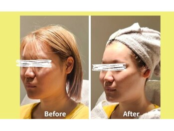 アン 銀座(ann)/別人級