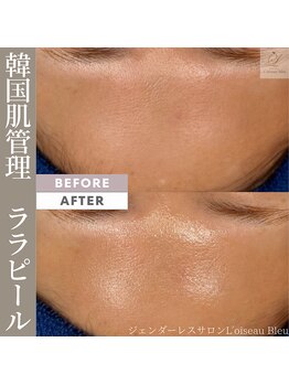 ロワゾーブリュ 代官山店(L'oiseau Bleu)/ララピール