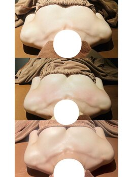 ロココ 豊田店(Rococo)/ビフォーアフター