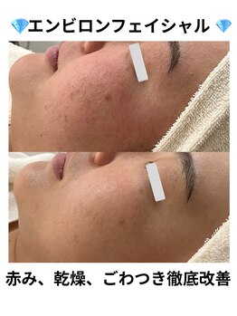 サロン ド ヴェール 一宮店(Salon de Vert)/エンビロントリートメント