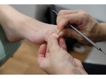 足のトラブルセンター 狸小路店/実は巻き爪ケアの老舗です