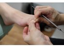 実は巻き爪ケアの老舗です