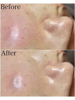 ブラックボックス(BLACK BOX)/20代女性のお客様