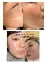 ラマジ(Lamazi)/肌改善・スキンケアレッスン