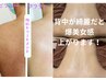 【背中ケア/ブライダル】背中美人ハーブピーリング★ プレゼント付￥22000⇒
