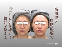 ジュジュ(juju)の雰囲気（Wアプローチで叶える小顔・たるみケア）