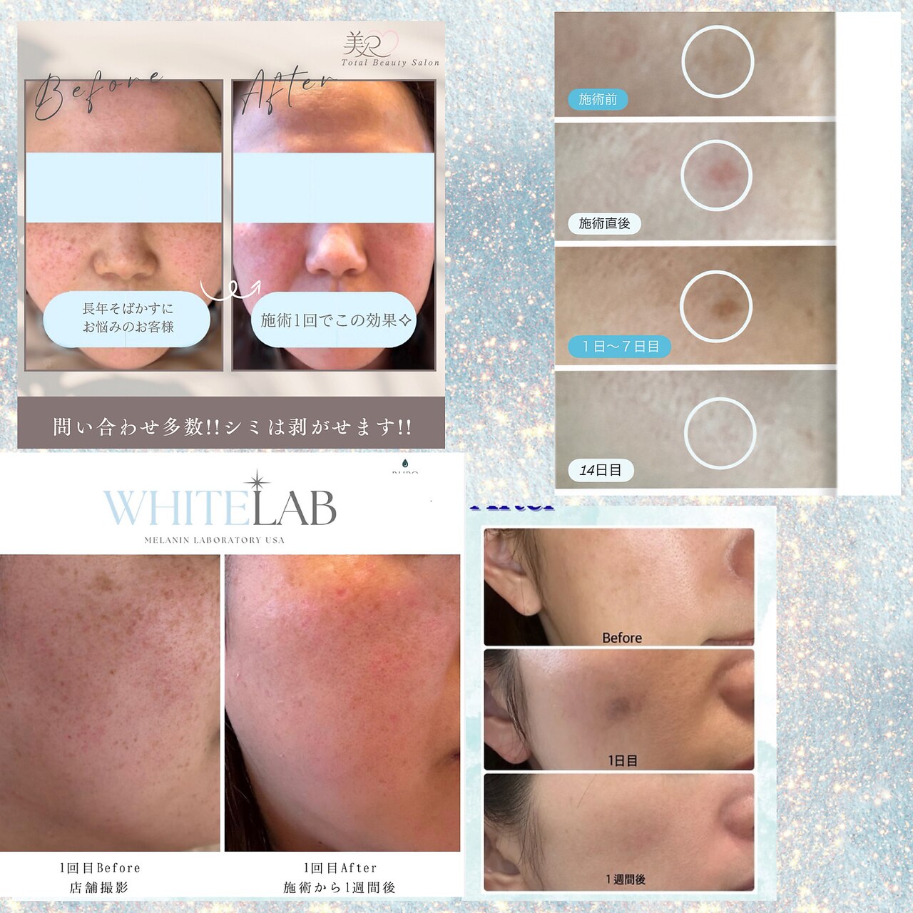 美R｜ホットペッパービューティー