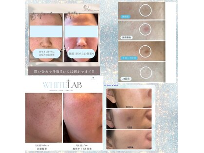 美Rの写真