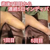 スマイルミー
