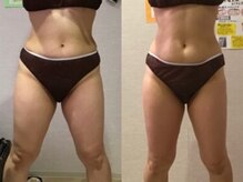 フェアリー 小松店/【痩身】大人気セルゼロ！