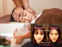 きらめき ワンライフ 川口(One Life)の雰囲気（結果重視の小顔矯正☆ブライダルOK！撮影前のモデルさんにも人気）