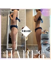 ハレアンド(Hare&)/30代半身10回目Before &nbsp;After
