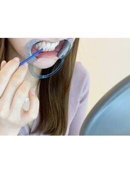 定額/月額メニューのあるサロン