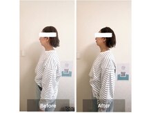 ラニ(Lani)/小顔美人整顔