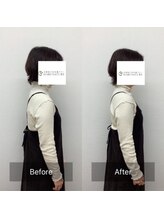 ハリナチュレ 西心斎橋店(HARINATURE)/Before After