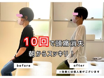 なかもず 輝き美容整体院/10回で頭痛が消失！