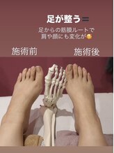 リル(Rire)/全身美容矯正メニュー