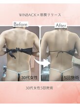 ラグーン(Lagoon)/WNBACK×筋膜リリース