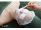 プレジール(Plaisir)の写真/ニキビケア・毛穴・赤みに◎話題の菌活ピーリングで美肌へ
