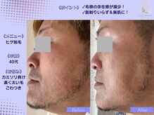 リリーベル 新宿歌舞伎町(Lily Belle)の雰囲気（ヒゲ脱毛/メンズ脱毛/美肌/トーンアップ/清潔感アップ）