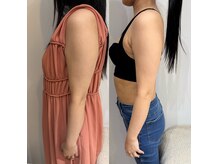 サロンノコ(salon NOKO)の雰囲気（針を使わないエアインジェクションで引き締め特化の美容液を導入）