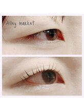 アリーマーケット(ALLEY MARKET)/