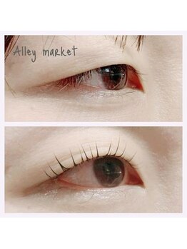 アリーマーケット(ALLEY MARKET)/