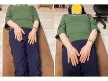 康整体院/腕の長さが、、ヤバい。汗