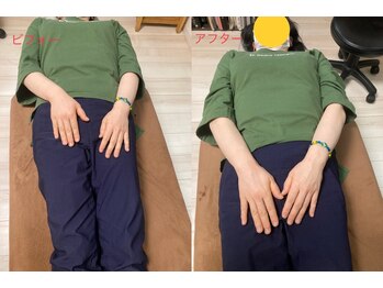 康整体院/腕の長さが、、ヤバい。汗