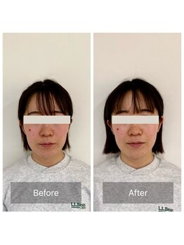 ハリラボ(hari Lab.)/【お客様の声】