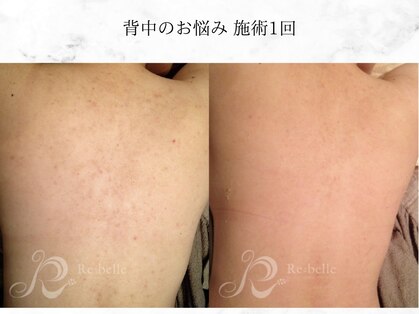クリーンアンドビューティ 札幌(Clean&Beauty)の写真