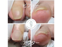 ネイルサロン エム ウェリナ(M Welina)の雰囲気（巻き爪・変形爪など、どんなお爪もお任せください！）