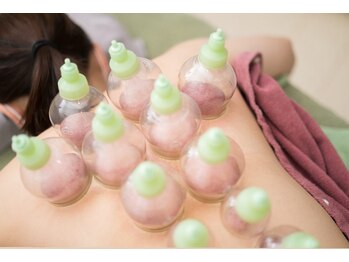 田中整骨鍼灸院 福岡白金院/カッピング