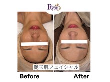 アールユー ギンザ(Ryou ginza)の雰囲気（小顔/肌質改善プログラム/艶肌）