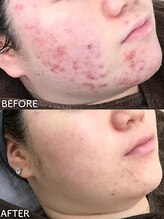 ビアンカ/お客様のお声