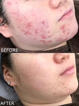 ビアンカ/お客様のお声