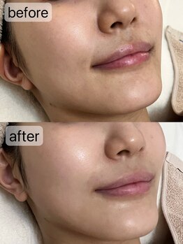 フェリノ(FERINO)/エンビロンAHAトリートメント