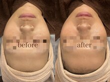 サロン エム(saron M)/お客様ビフォーアフター