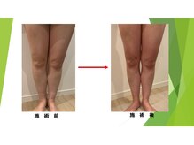 肩こり・冷え・むくみ・更年期・代謝の低下などしっかりケア