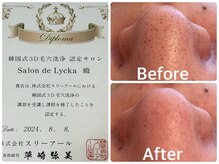 サロンドリュッカ(Salon de Lycka)の雰囲気（韓国式３D毛穴洗浄でお顔まるごと毛穴洗浄、ピーリング効果も◎）