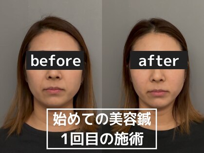 オアソラ(oasora)の写真