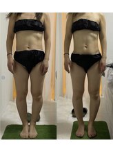 ウル(Ulu)/腸もみビフォーアフター